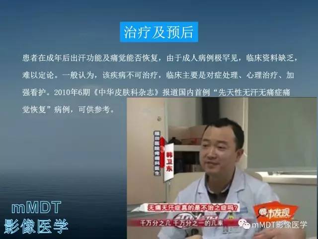 【PPT】无痛无汗症的影像诊断