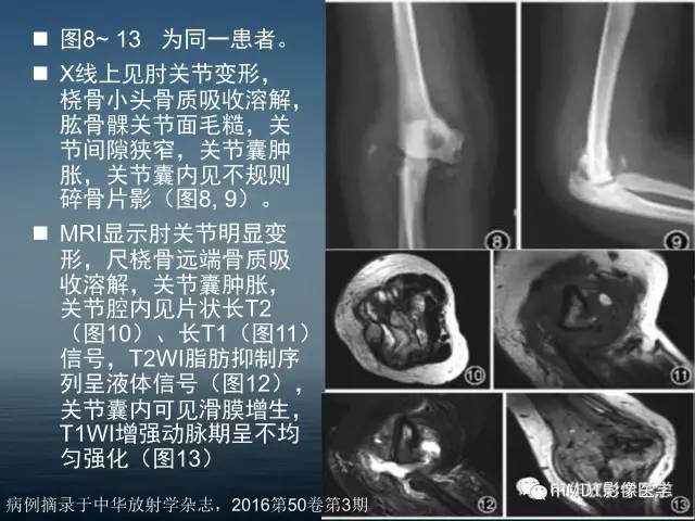 【PPT】无痛无汗症的影像诊断