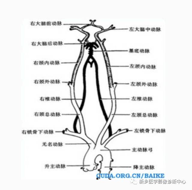 头颈部血管常见变异35例汇总 头颈部血管常见变异35例汇总