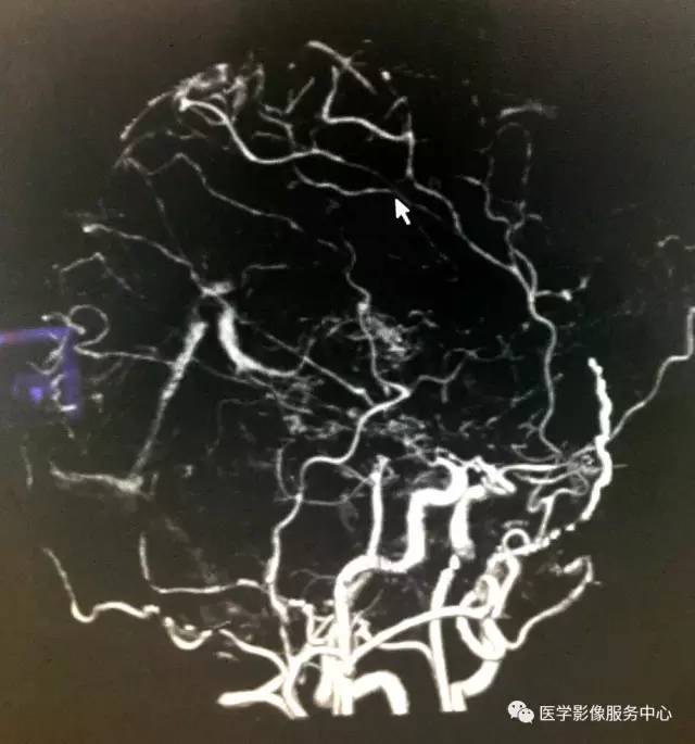 【病例】仅凭一层CT图像即可确诊这个疾病,你能做到吗? 【病例】仅凭一层CT图像即可确诊这个疾病,你能做到吗?