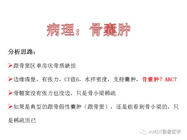 【PPT】跗骨病变影像分析思路