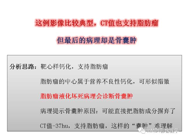 【PPT】跗骨病变影像分析思路