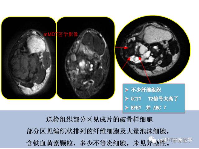【PPT】跗骨病变影像分析思路