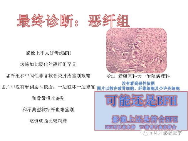 【PPT】跗骨病变影像分析思路