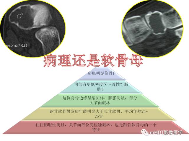 【PPT】跗骨病变影像分析思路