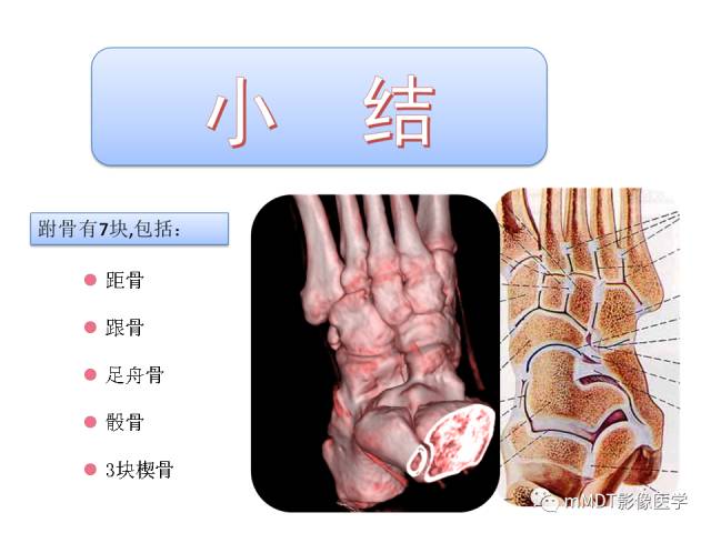 【PPT】跗骨病变影像分析思路