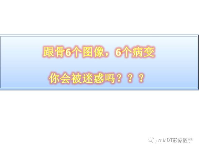 【PPT】跗骨病变影像分析思路