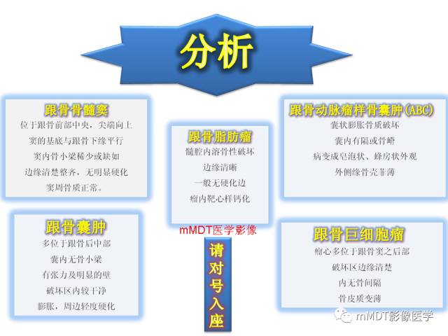 【PPT】跗骨病变影像分析思路