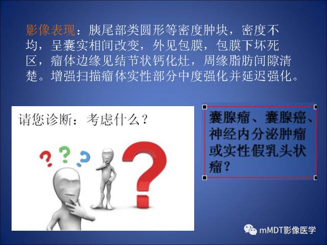 【PPT】胰腺实性假乳头状瘤诊断及鉴别