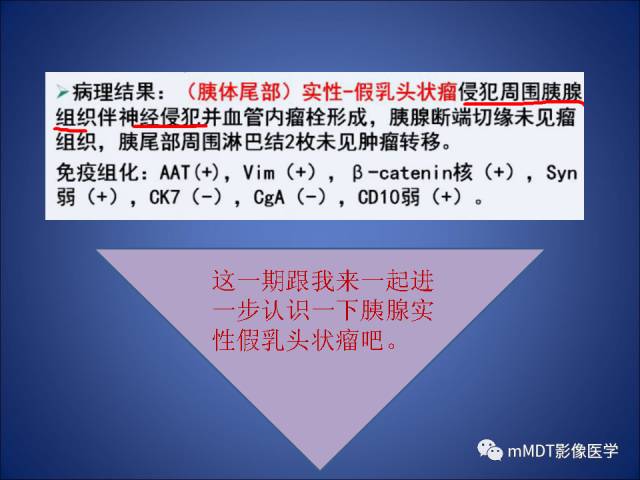 【PPT】胰腺实性假乳头状瘤诊断及鉴别