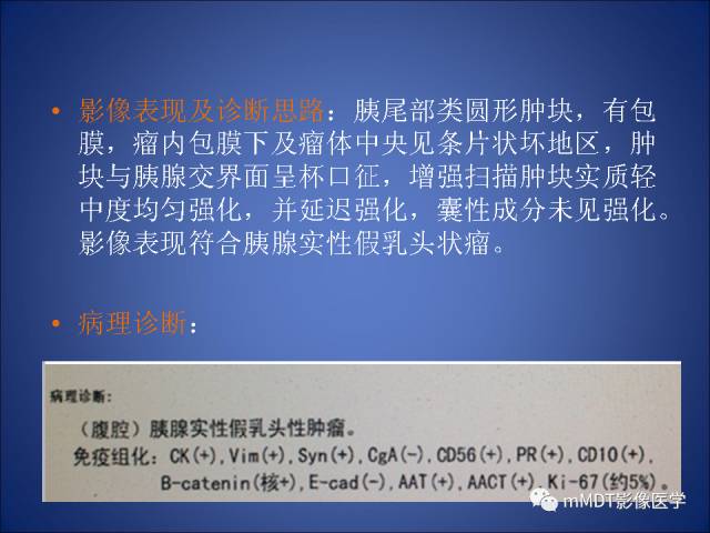 【PPT】胰腺实性假乳头状瘤诊断及鉴别