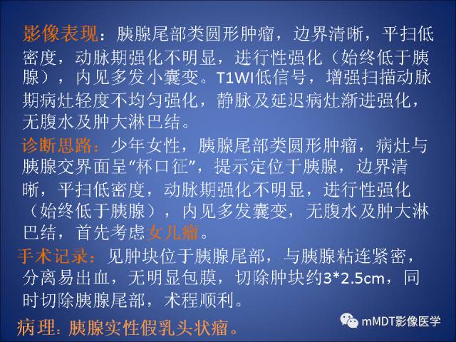 【PPT】胰腺实性假乳头状瘤诊断及鉴别