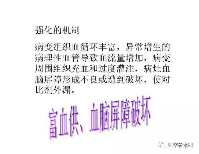 【PPT】脑肿瘤CT和MR诊断和鉴别诊断
