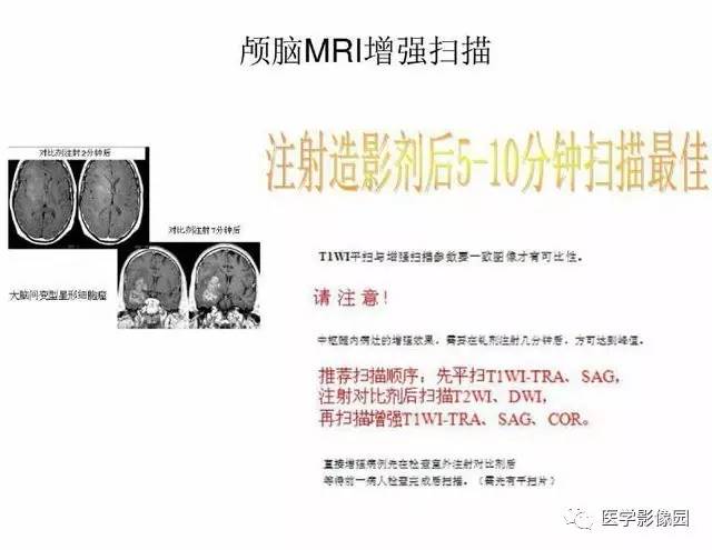 【PPT】脑肿瘤CT和MR诊断和鉴别诊断