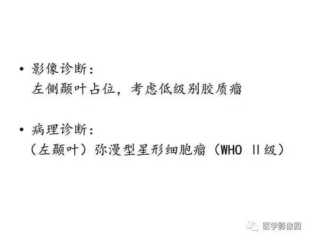 【PPT】脑肿瘤CT和MR诊断和鉴别诊断