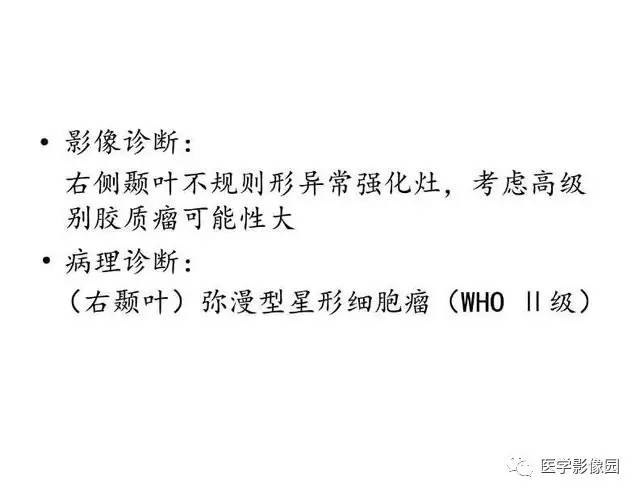 【PPT】脑肿瘤CT和MR诊断和鉴别诊断