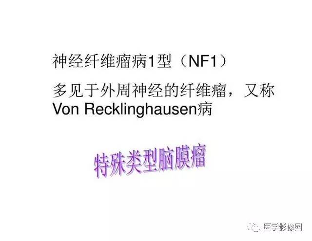 【PPT】脑肿瘤CT和MR诊断和鉴别诊断