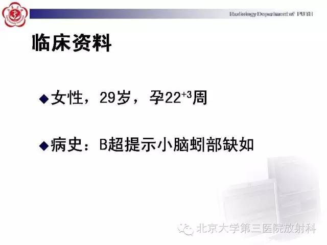 【病例】Dandy-Walker综合征1例MR影像诊断