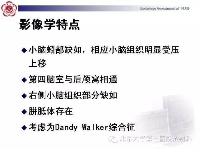 【病例】Dandy-Walker综合征1例MR影像诊断