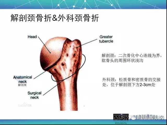 【PPT】肩关节损伤（骨折篇）