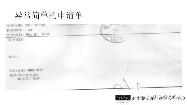 【PPT】肋骨骨折诊断经验分享