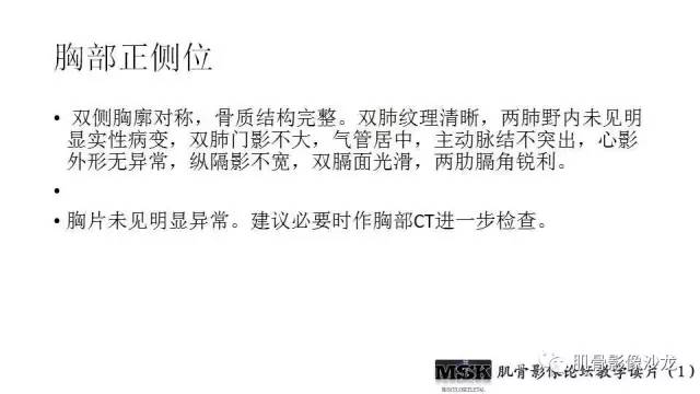 【PPT】肋骨骨折诊断经验分享