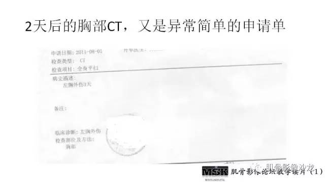 【PPT】肋骨骨折诊断经验分享