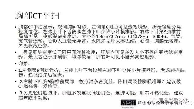 【PPT】肋骨骨折诊断经验分享