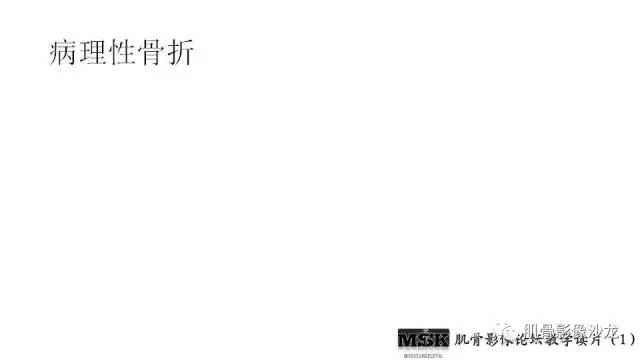 【PPT】肋骨骨折诊断经验分享