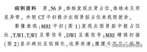 【病例】肾集合管癌1例CT影像诊断思路