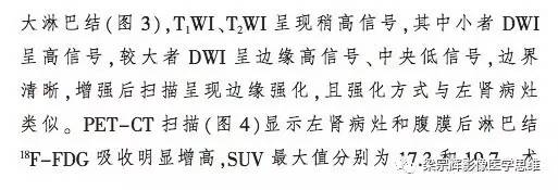 【病例】肾集合管癌1例CT影像诊断思路