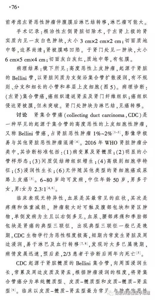 【病例】肾集合管癌1例CT影像诊断思路