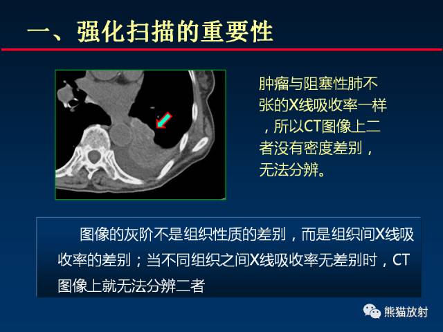【PPT】CT扫描及后处理技术在胸部疾病中的价值