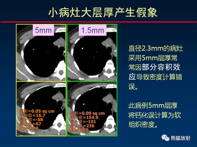 【PPT】CT扫描及后处理技术在胸部疾病中的价值