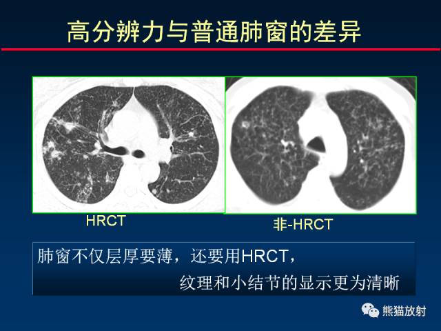 【PPT】CT扫描及后处理技术在胸部疾病中的价值