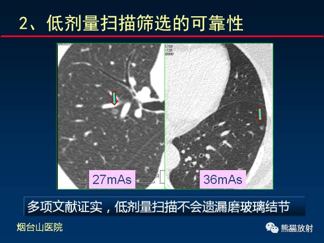 【PPT】CT扫描及后处理技术在胸部疾病中的价值