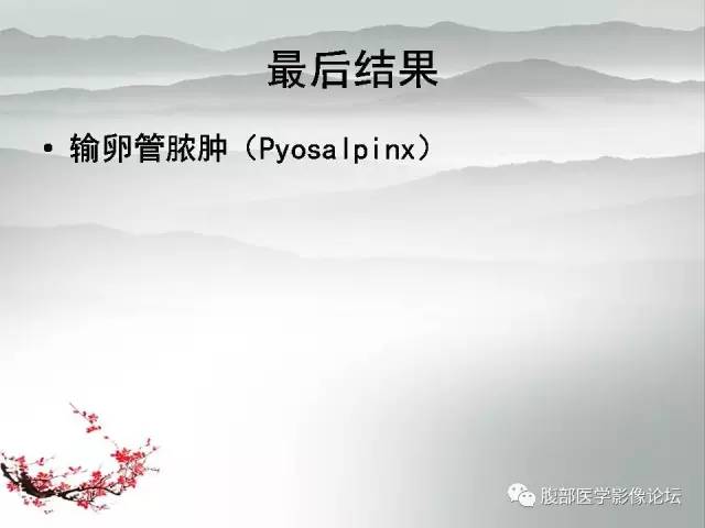 【病例】输卵管脓肿1例MR影像表现