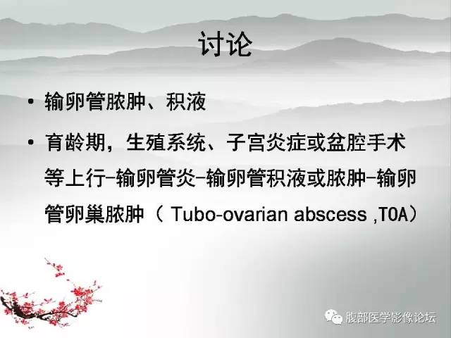 【病例】输卵管脓肿1例MR影像表现