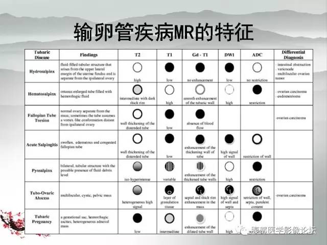 【病例】输卵管脓肿1例MR影像表现