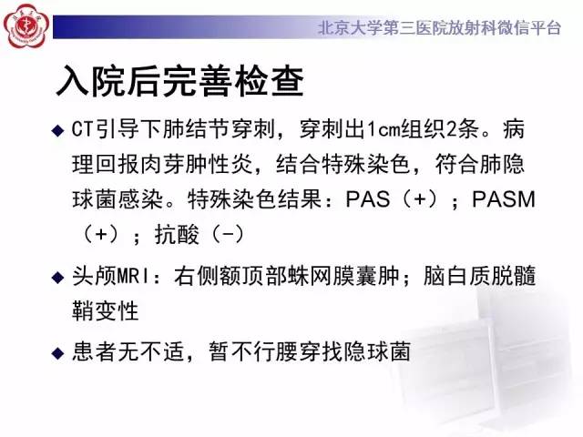 【病例】肺隐球菌病1例CT影像表现
