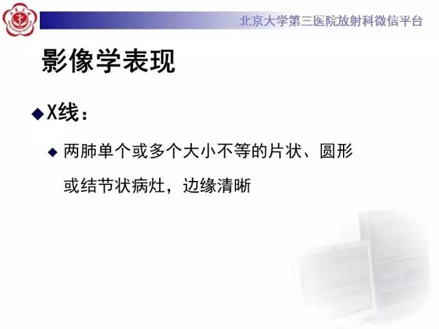 【病例】肺隐球菌病1例CT影像表现