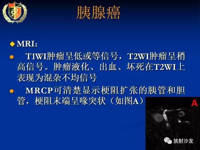 【PPT】胰腺疾病的影像诊断