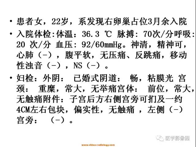 【病例】卵巢纤维瘤1例CT影像表现