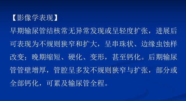 【PPT】泌尿系疾病的影像诊断