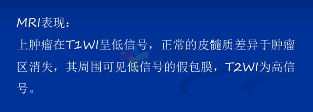 【PPT】泌尿系疾病的影像诊断