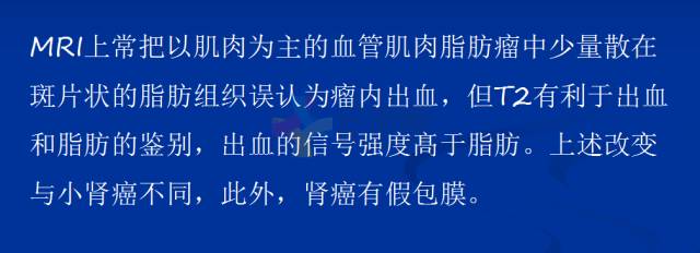【PPT】泌尿系疾病的影像诊断