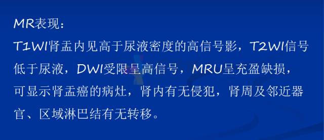 【PPT】泌尿系疾病的影像诊断