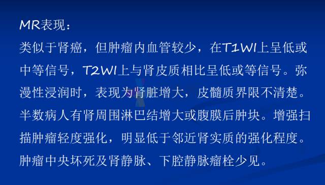 【PPT】泌尿系疾病的影像诊断