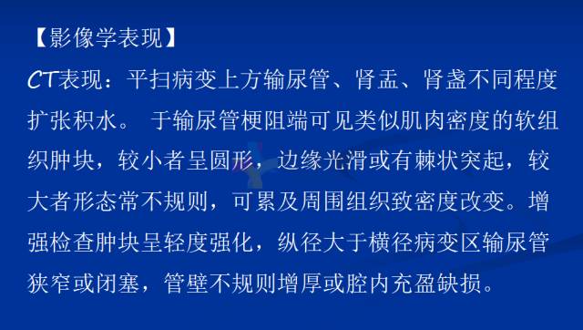【PPT】泌尿系疾病的影像诊断