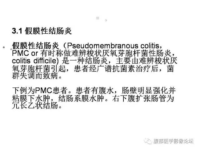 【PPT】肠道壁增厚CT表现